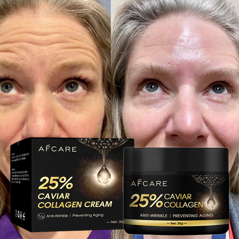 Afcare 25% Caviar Coulagen Anti-Wrinkle Preventing Aging Cream