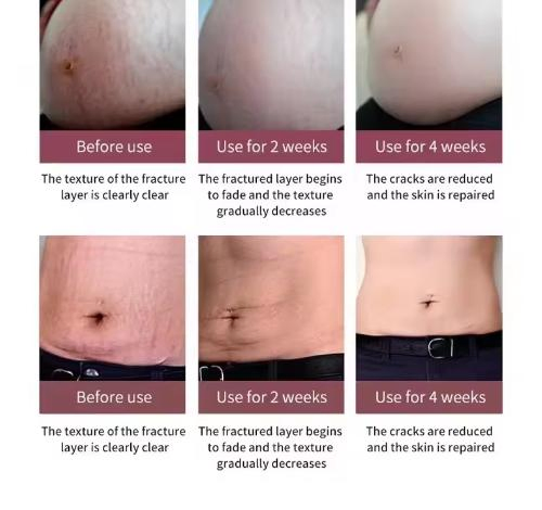 300g Stretch Marks Rose Massage Cream Body Lotion
