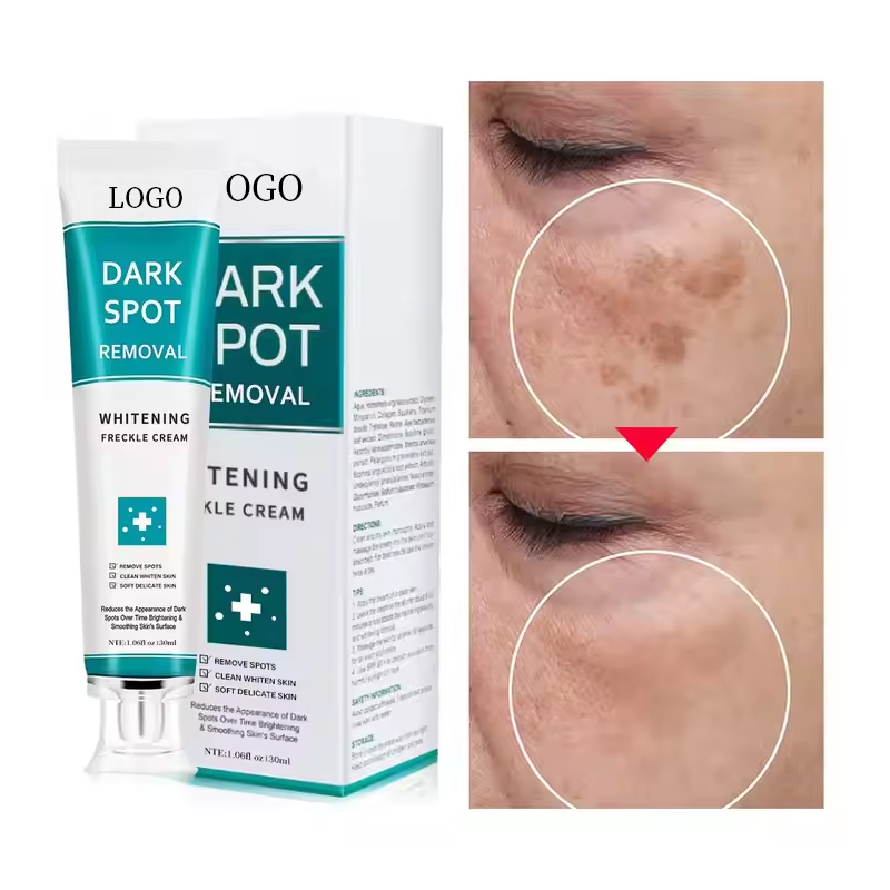 Di Tong OEM ODM Moisturizing, Whitening, and Spot Removing Cream