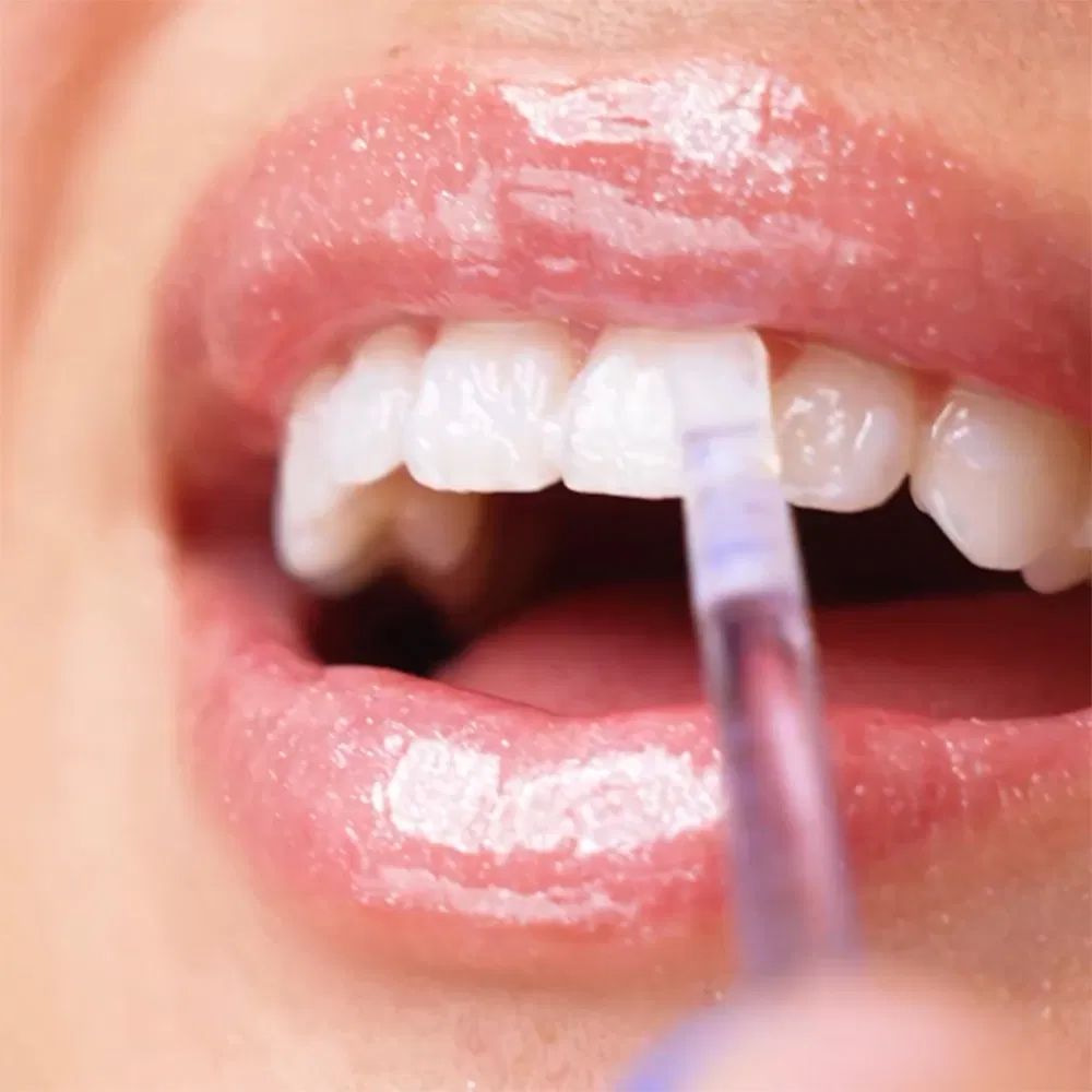 Teeth Whitening Pen Glorysmile Portable Tooth Gloss Instant Brightener