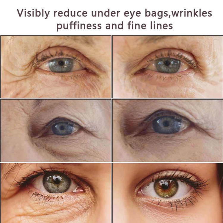 Factory Wholesale Anti Aging Wrinkles Rapid Reduction Under Eye Cream for Women