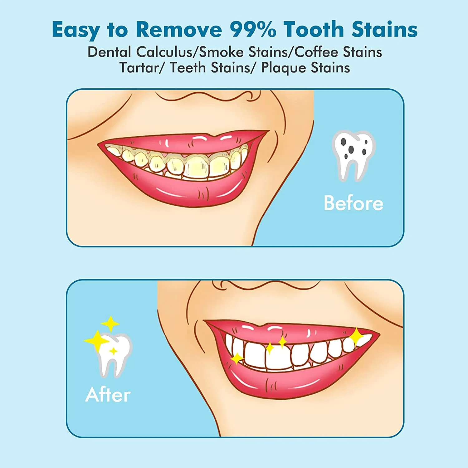Электрический набор для чистки зубов от налета и камня