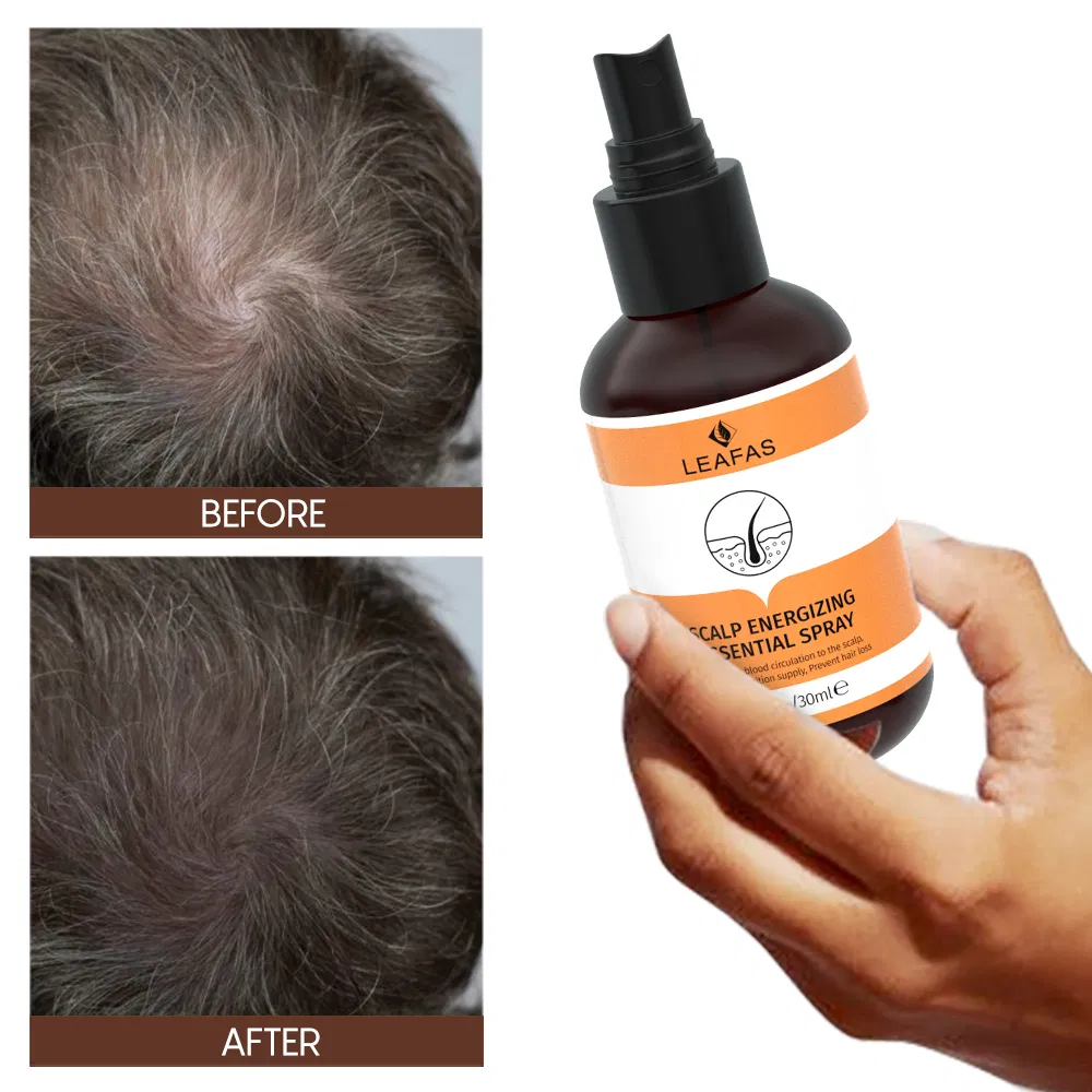 Private Label Hair Growth Oil for Men Women
