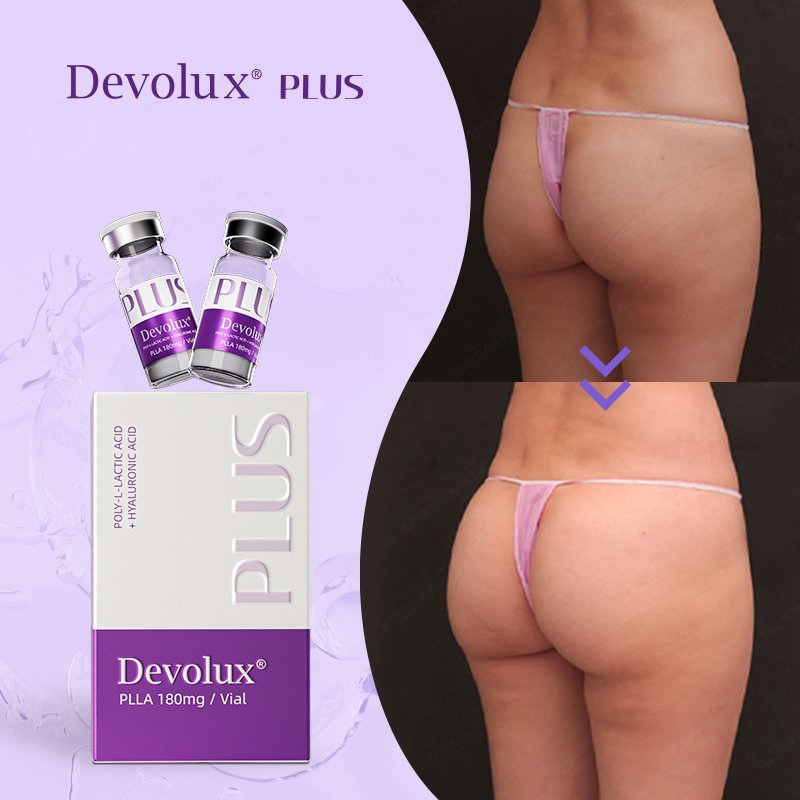 Devolux Plla Wholesale Poly-L-Lactic Acid for Buttocks with Immediate Results After Injection
