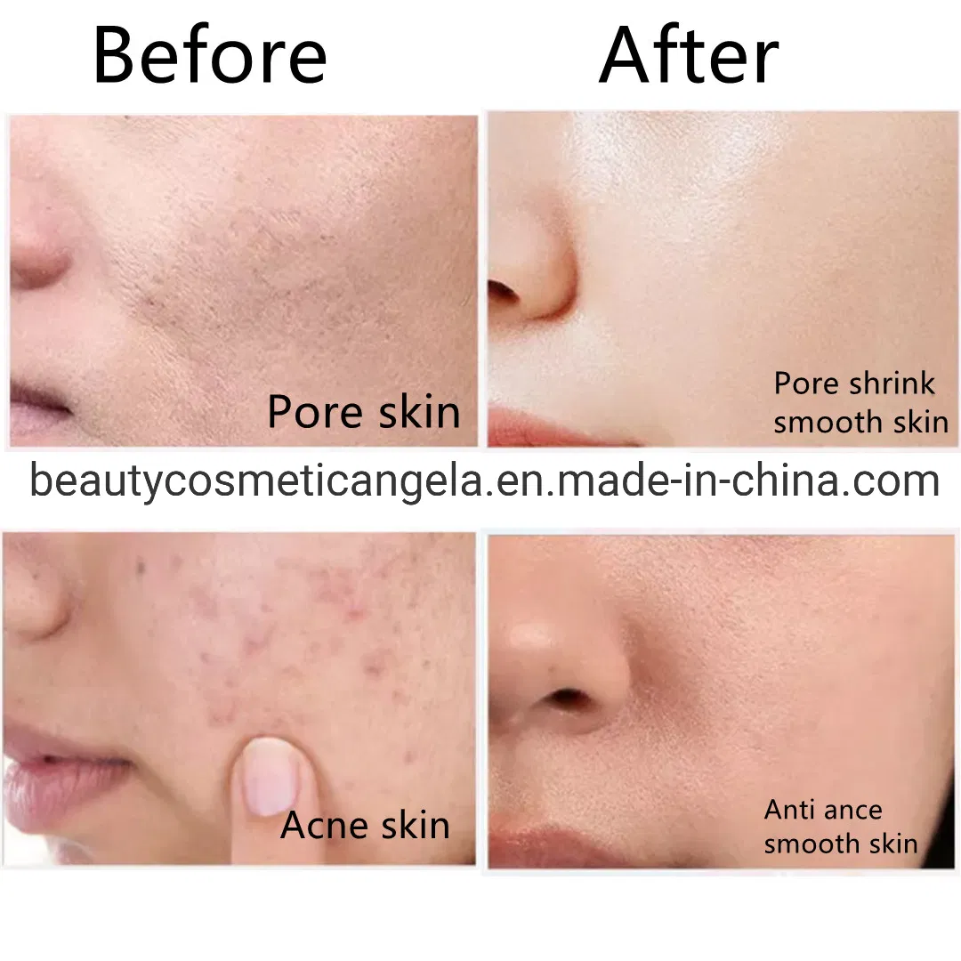Arbutin Nicotinamide Skin Brightening Body Cream 7 Days Whitening