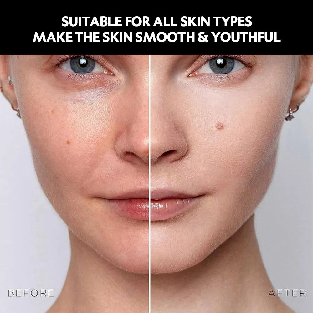 40% Vcip Niacinamide Whitening Face Cream Moisturizing Brightening