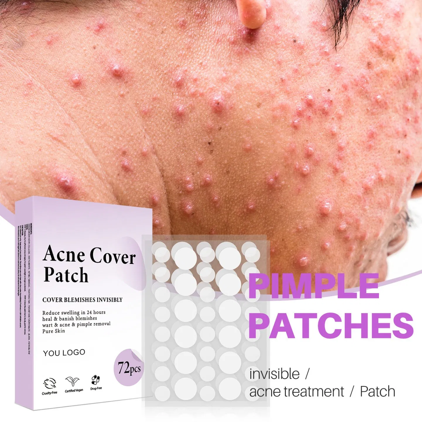 Beauty Cosmetics Skin Care Blemishes Spots Hydrocolloid Patches Pimple Patch Acne Patch