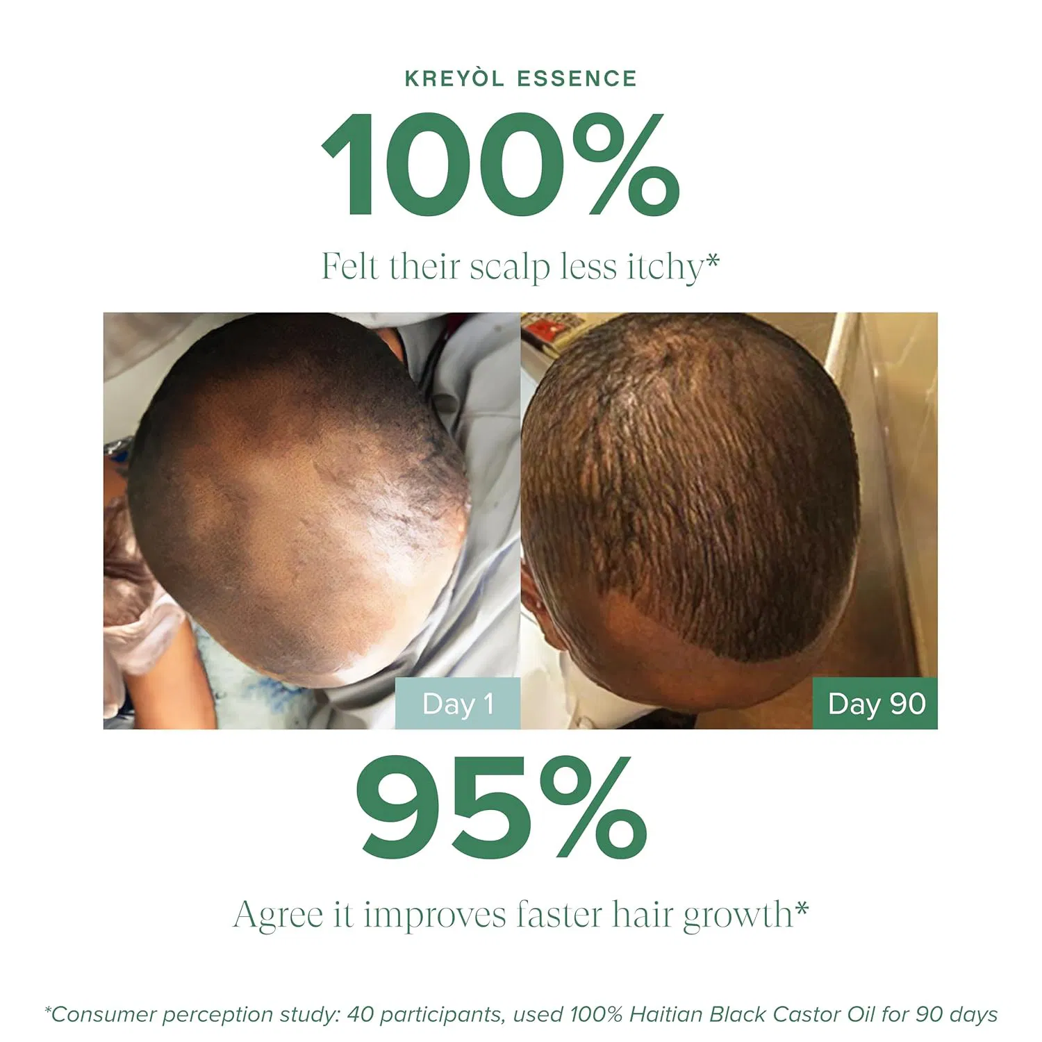 Youthful High Quality Hot Sale Hair Oil for Man and Women