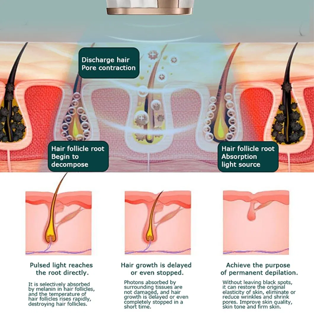 New Freezing Point Laser Painless Whole Body Hair Removal Machine