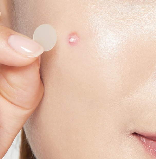 36 Dots Hydrocolloid Tea Tree Acne Plaster Pimple Master Acne Patch Manufacturer