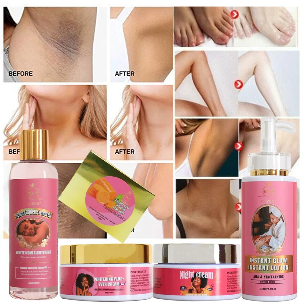 Best Skin Whitening Natural Carrot Vitamin a Vitamin C Glutathione Best Skin Lightening Whitening Kits