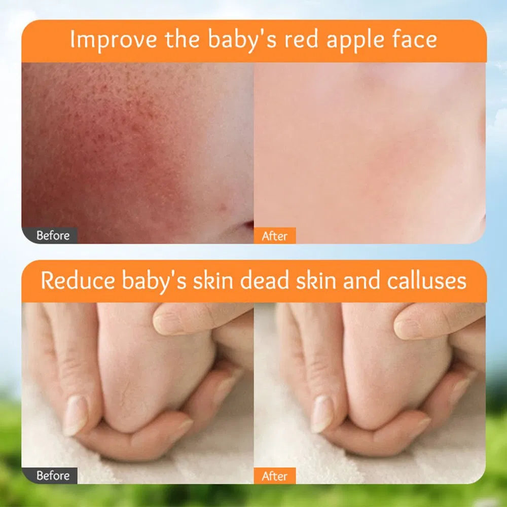 Baby Calendula Natural Moisturizing Hydrating Anti-Chapping Soothing Refreshing Skin Cream