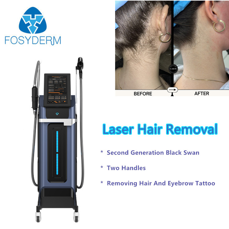 Laser Hair Removal Machine Black Swan Laser Tattoo Removing Double Handles
