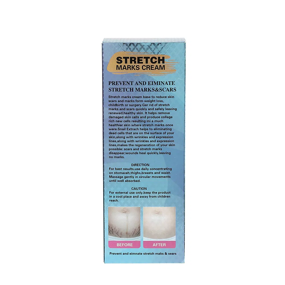 Factory Sales Moisturizing Natural Snail Extract Nourishing Eliminate Stretch Mark Skin Repair Cream