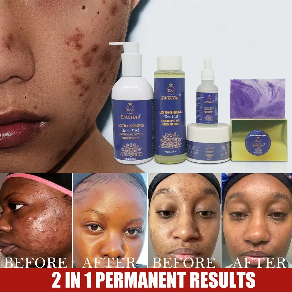 OEM Anti Acne Glutathione Whitening Skin Sets Antioxidant Repair Skin Beauty Brighten Face Sets