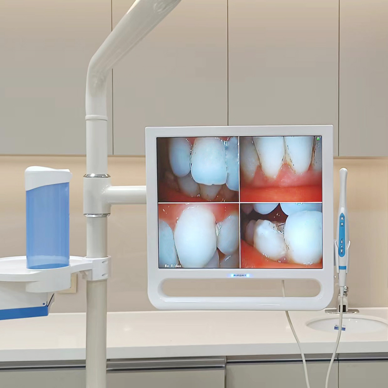 Best VGA Dental Intraoral Camera with 17 Inch Screen System Connect for Dental Unit