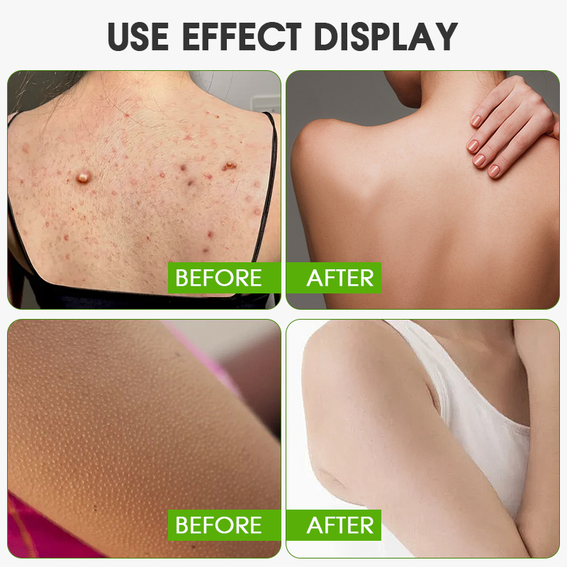 Private Label Coconut Scrub Organic Bath Salt Improve Chicken Skin Exfoliant Whitening