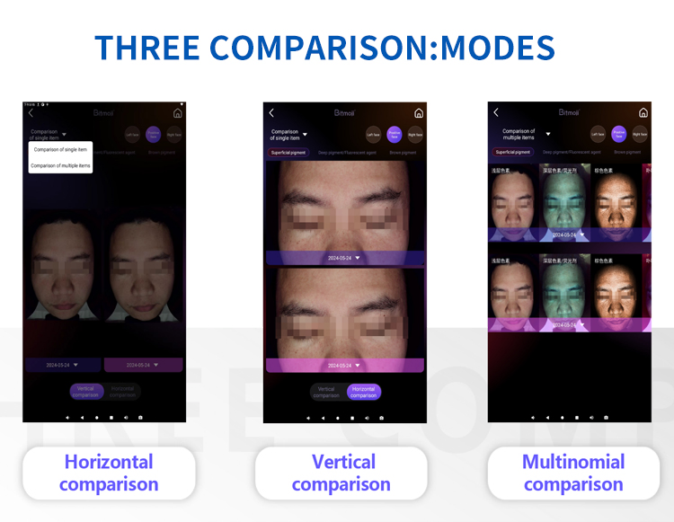 2026 New Ai High Definition Skin Analyzer Face Lifting System 32g Deep Penetration Reaction Skin Problems Skin Analyzer Machine