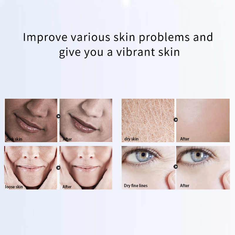 Anti Acne Dark Spot Remover Brightening Whitening Vitamin C Facial Essence Powder
