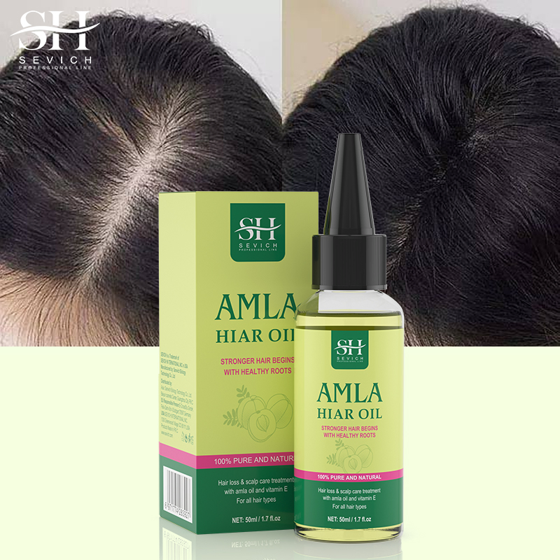 Hot Sell Hair Care Loss Treatment Amla Hair Growth Serum Oil