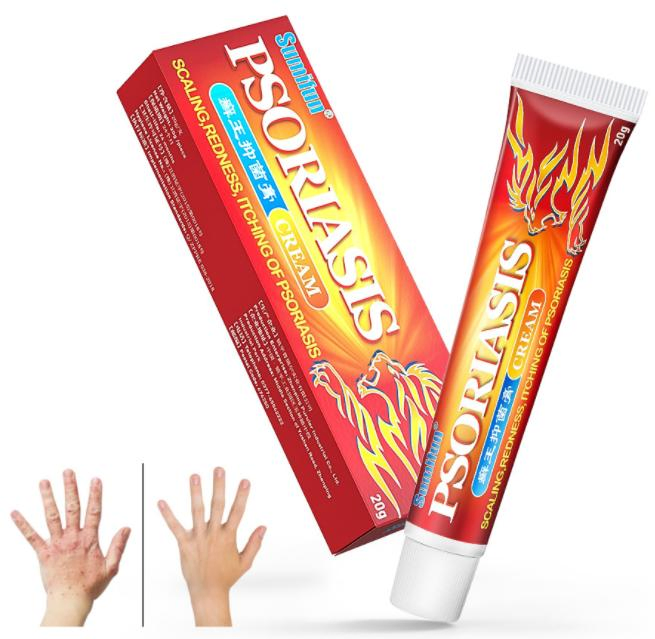 Natuural Herbal Psoriasis Eczema Cream for Dermatitis Pruritus Eczematoid