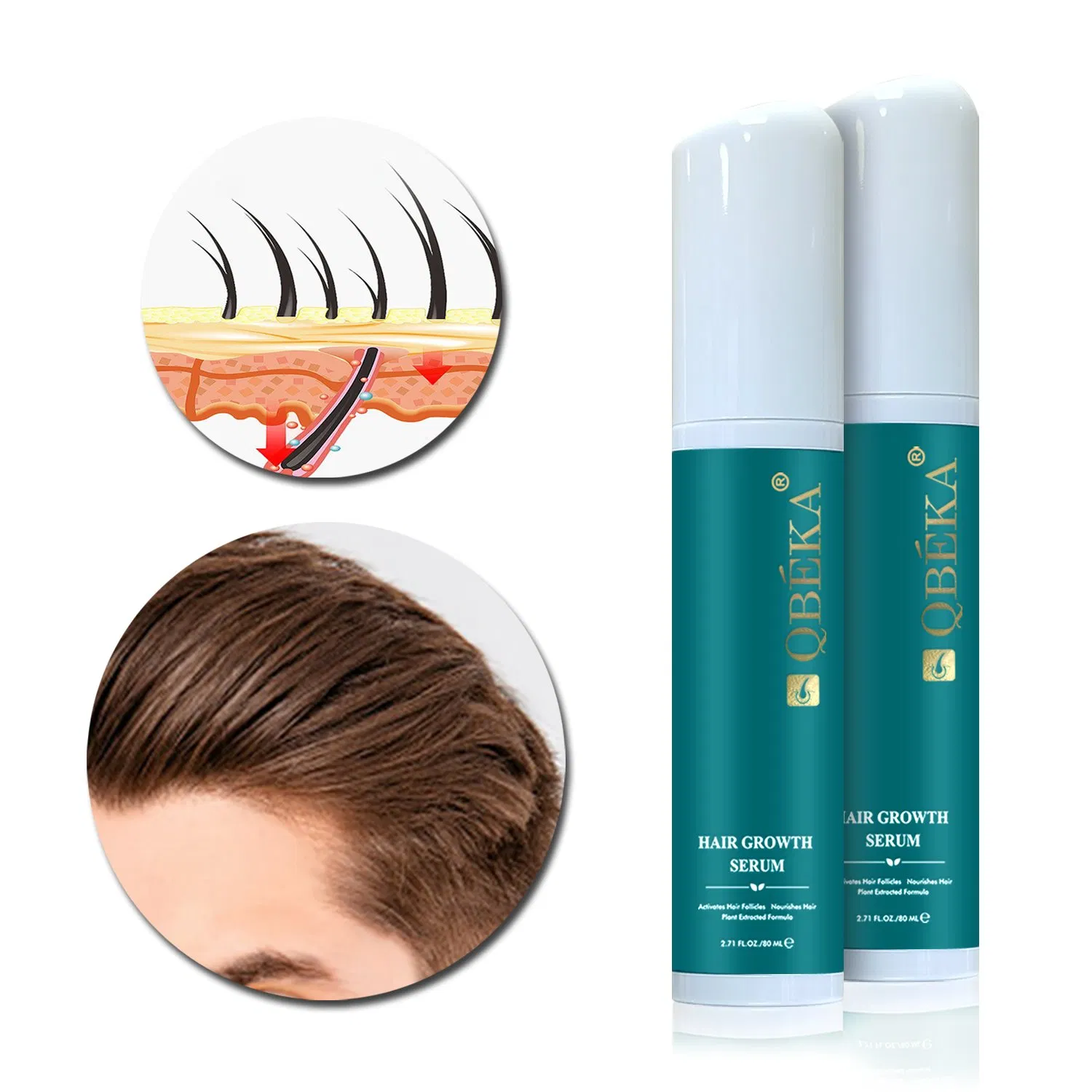 High-Quality Qbeka Strengthens and Stimulates The Scalp to New Hair Growth and Prevent Hair Loss Enhance Hair Growth Nourishing Hair and Scalp Serum