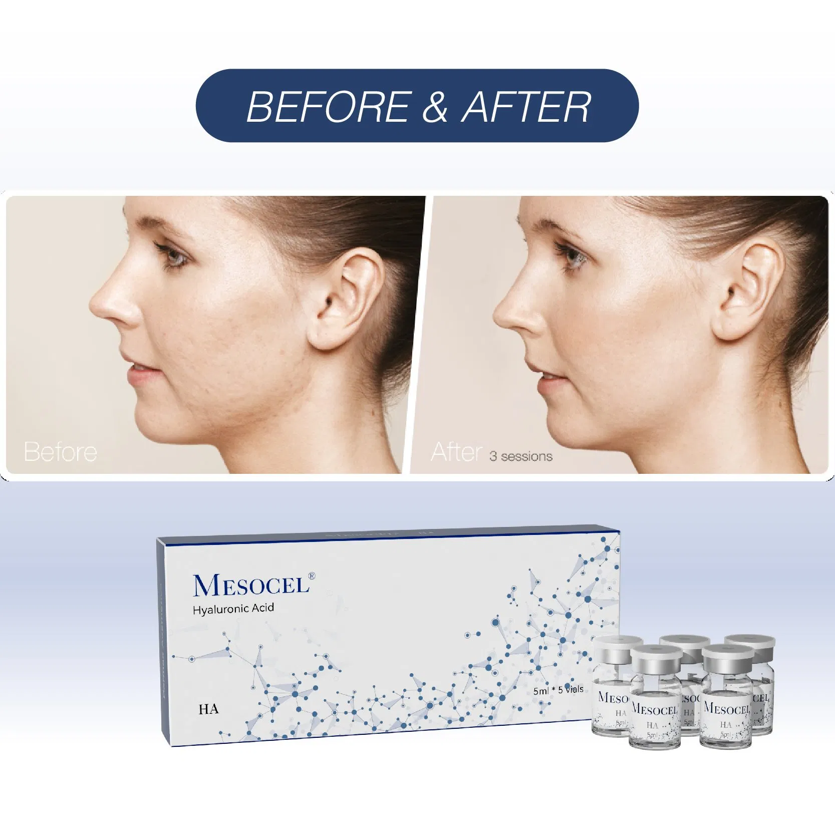 Face Whitening and Moisturizing Essence Anti Wrinkles Microneedling Serum Kit