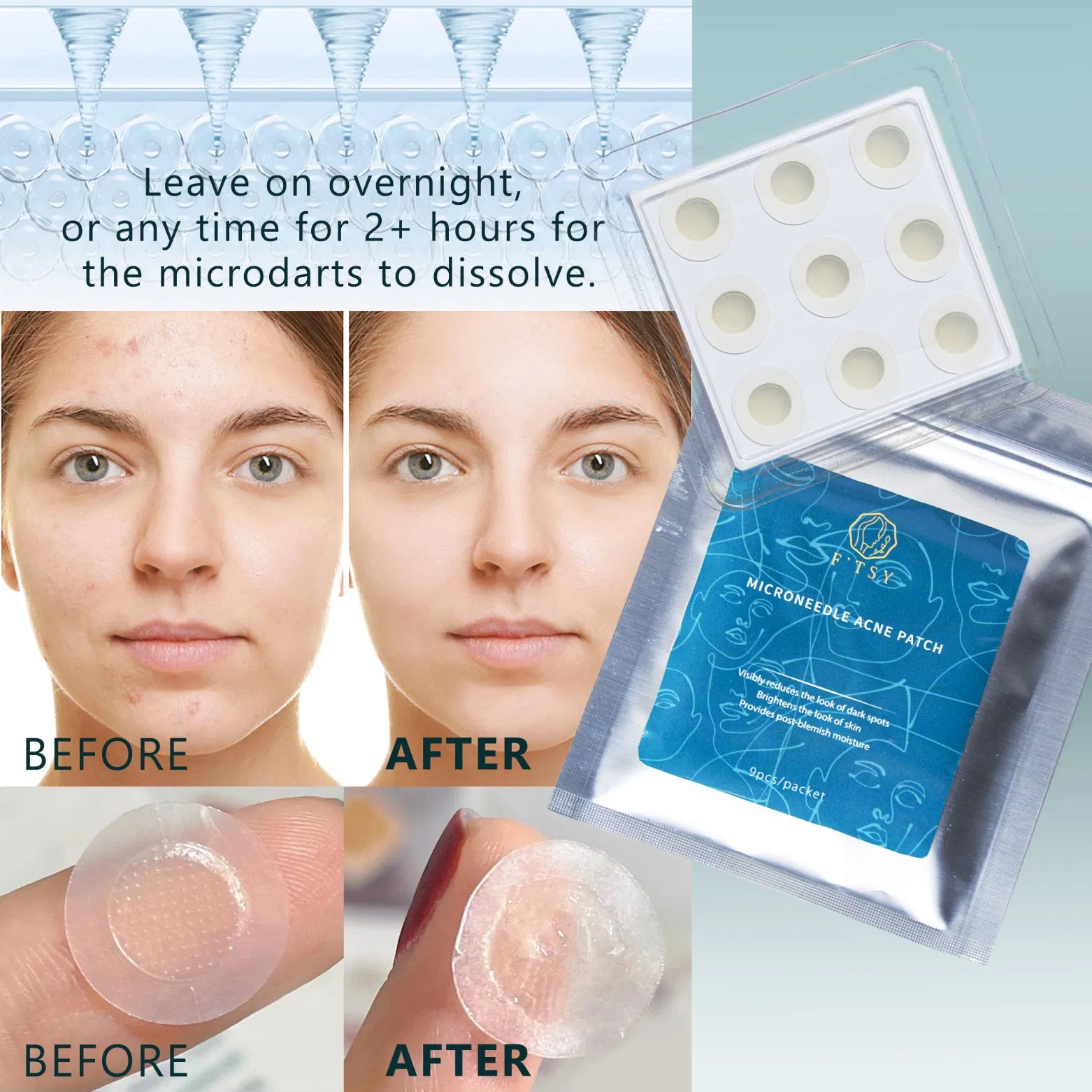 Customized Acne Spot Treatment Pimple Patch Box Face Microneedle Hydrocolloid Acne Pimple Patch