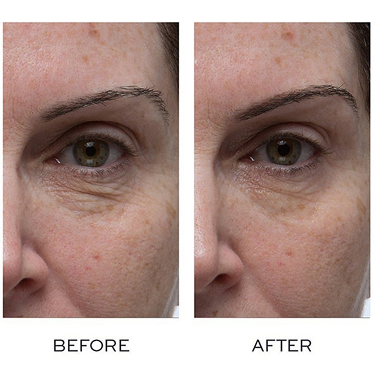 OEM ODM Advanced Reviving Skin Brightening & Hydrating Eye Cream