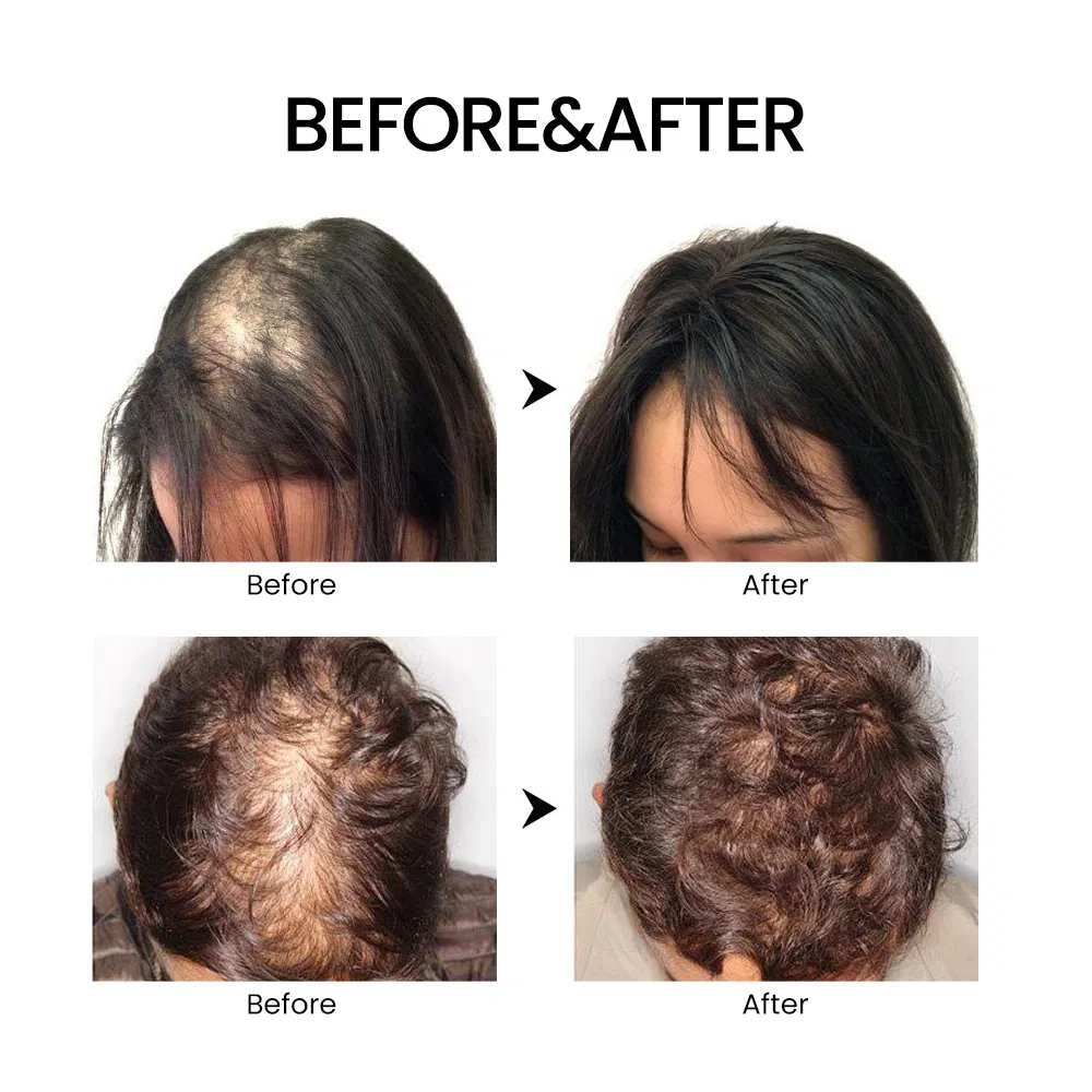 Pure Batana Hair Care Set Nourishing Batana Oil Shampoo and Conditioner