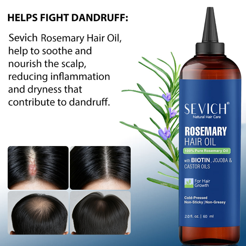Factory Wholesale Natural Herbal Rosemary Biotin Hair Essential Oil 60ml Repair Hair Growth Serum Oil