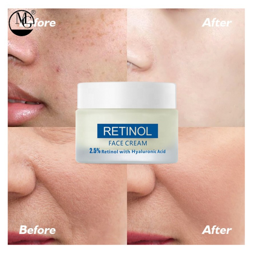 Lightweight Anti Wrinkles Personal Care Face Cream with CE