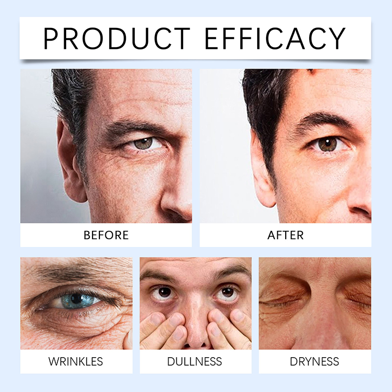 Soothing Man Eye Cream for Men to Restore Elasticity Reduce Redness