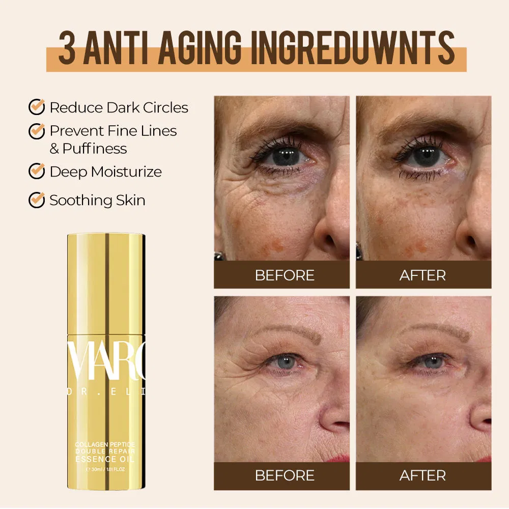 Anti-Aging Hyaluronic Acid Tightening Eye Cream for Firming Tightening Eye Bags