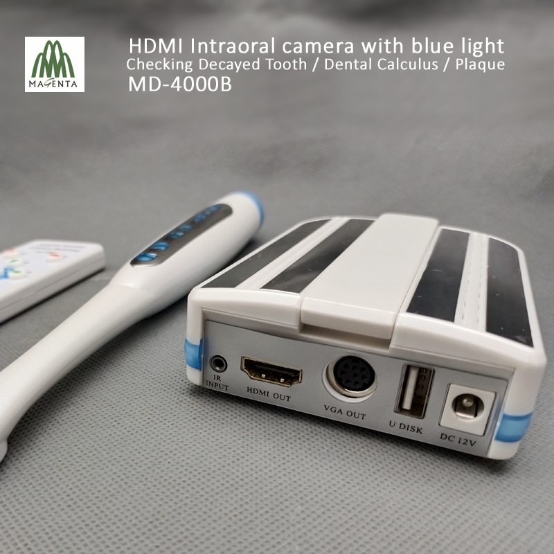 16: 9 Full Display HDMI and VGA Blue Light Dental Camera for Checking Dental Calculus / Decayed Teeth and Plaque