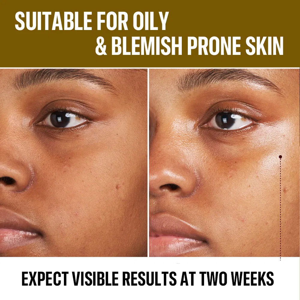 Improve Spots Fine Line Brighten Concentrated Serum with Vitamin C
