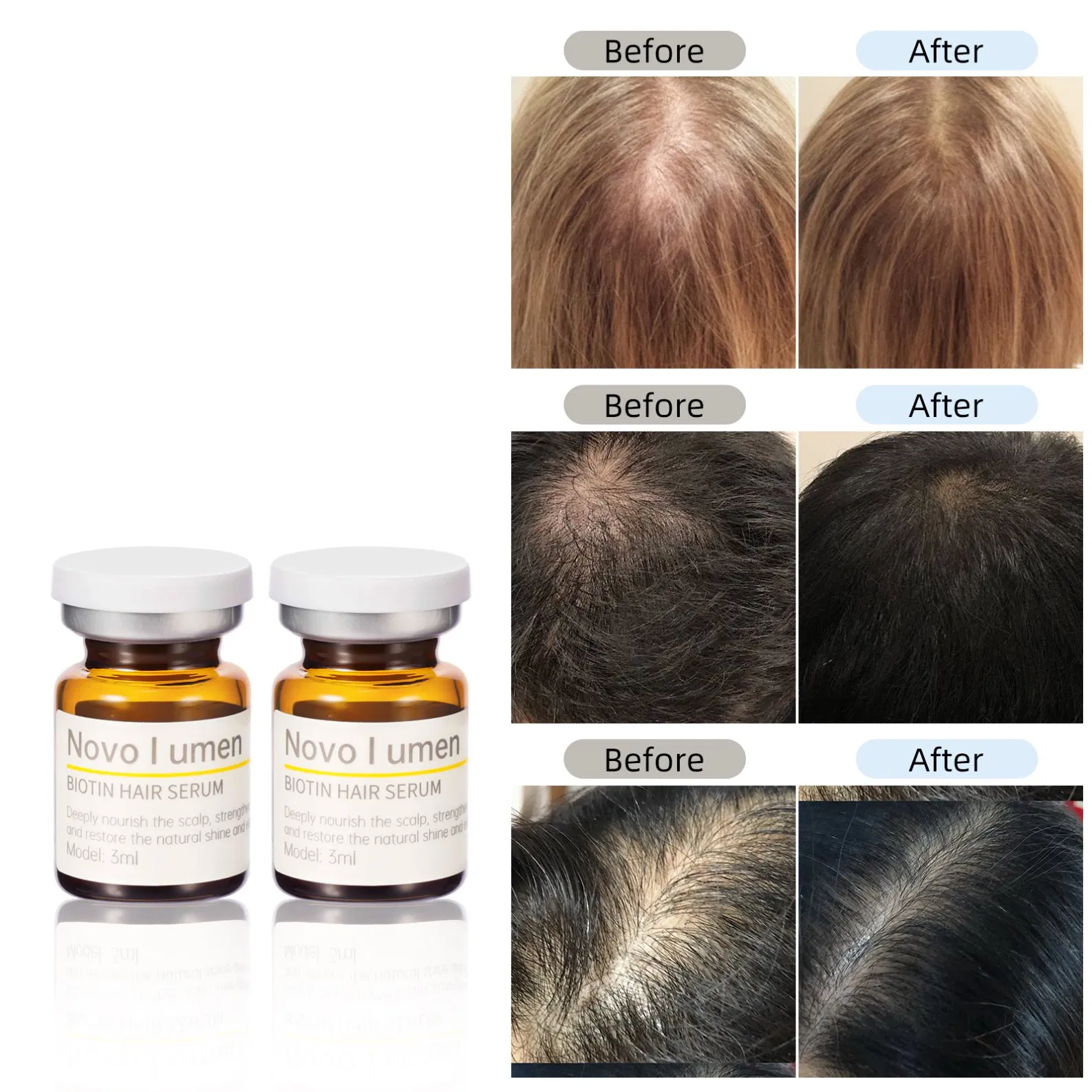 Fast-Acting Biotin Serum for Hair Growth and Volume Boost