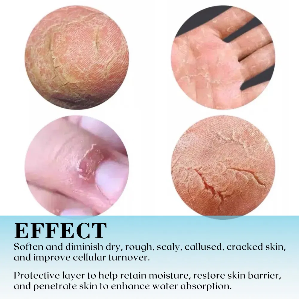 Custom Wholesale Vegan Nourishing Han Foot Urea Cream Shea Butter Anti Cracking Moisturizer