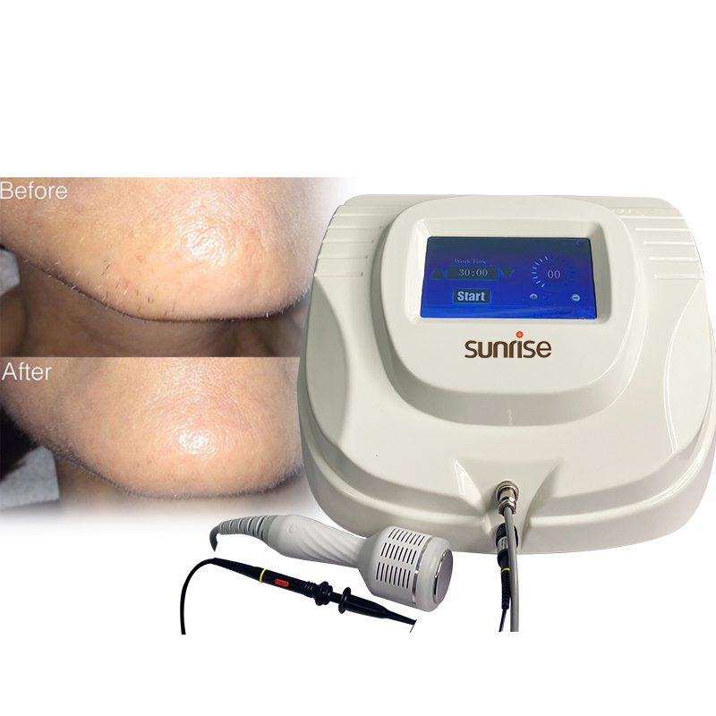 Rbs Electrolysis Permanent Hair Removal Machine with Electrolyse Needles for White Hair Removal