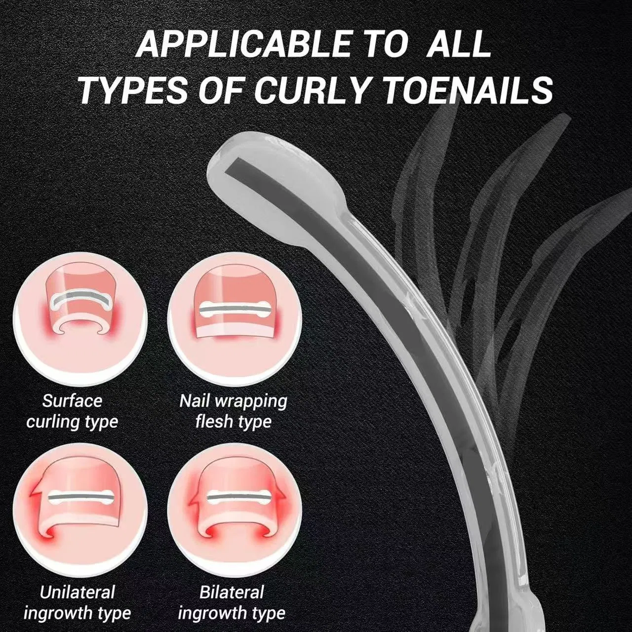 Professional Home Care for Curved Nails Titanium Alloy Ingrown Toenail Treatment