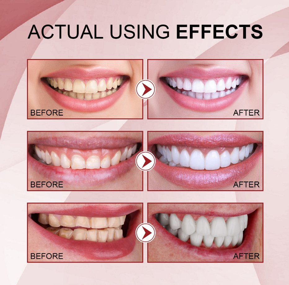 Online Wholesale and Retail Teeth Whitening Probiotics Baking Soda Toothpaste Remove Plaque Bleaching Tools Dental Care Charcoal Probiotics Toothpaste