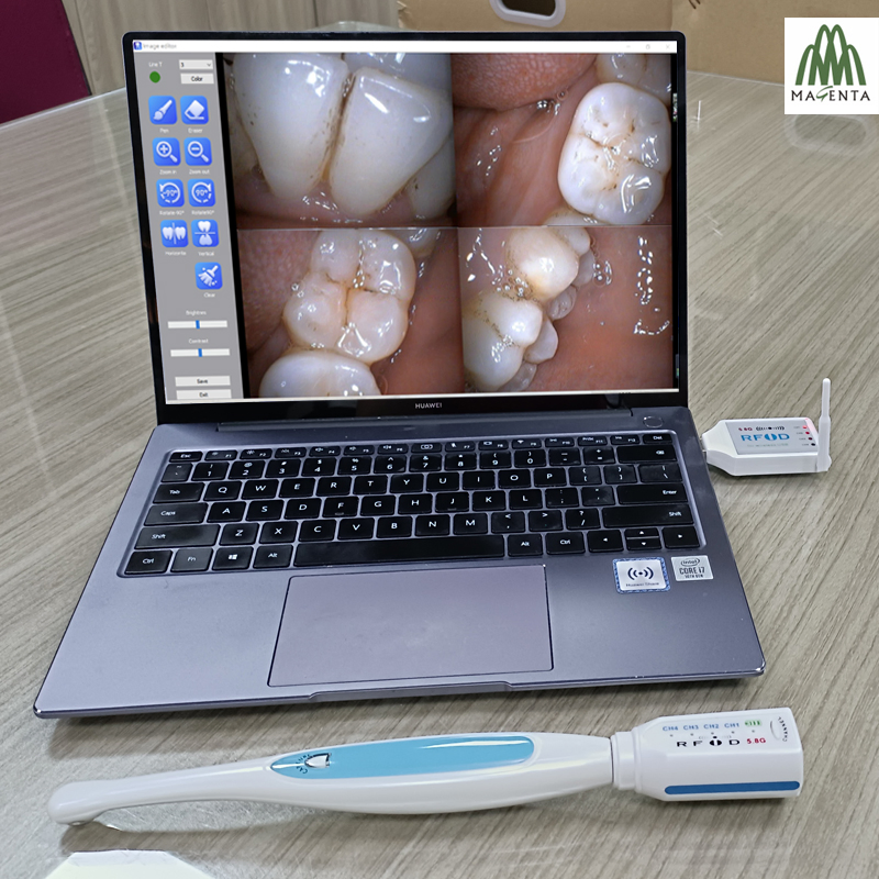 Sony CCD USB Wireless Dental Oral Camera Viewer for Dental Chair Computer