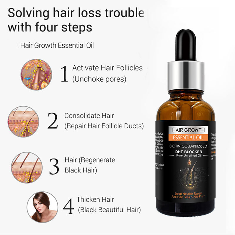 Private Label Hair Care Growth Oil Biotin Regrowth Treatment for Scalp Hair Loss Thinning Hair Growth Essential Oil