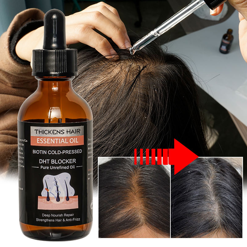 Fatazen Hair Growth Serum Oil Biotin Regrowth Treatment for Scalp Hair Loss Thinning Hair Growth Serum for Men Women