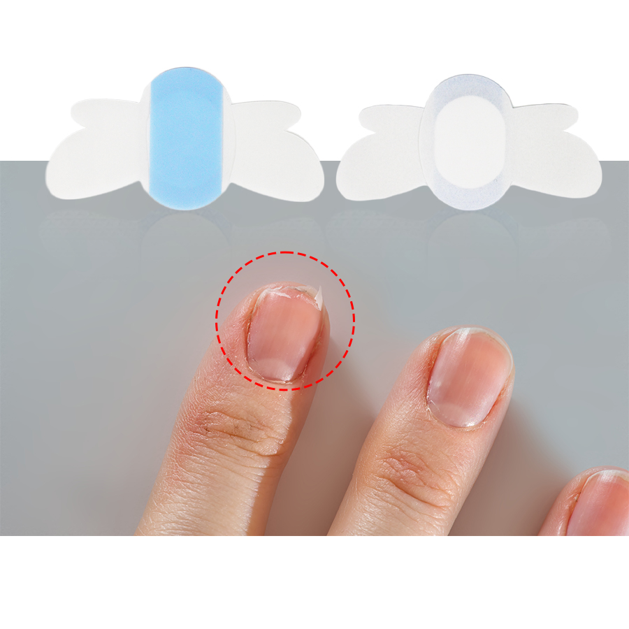 Multipurpose Nail Nutrition Patch Repair for Nails Vitamin C Ingredients