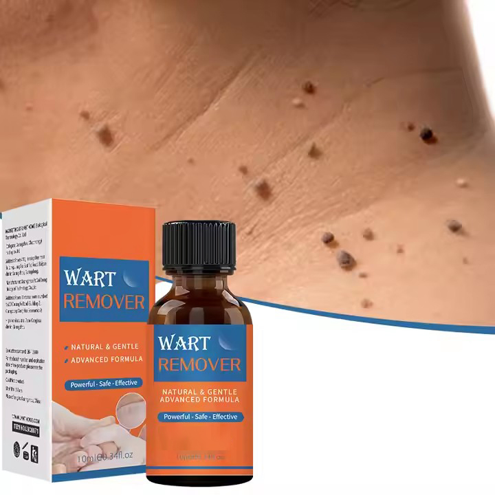 Beauty Cosmetics Skin Care Mild Powerful - Safe - Effective Wart Removing Oil