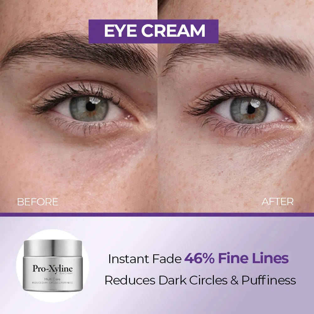 PRO Xyline Dark Circles Eye Bags Removal Lift Hydrating Under Eye Cream