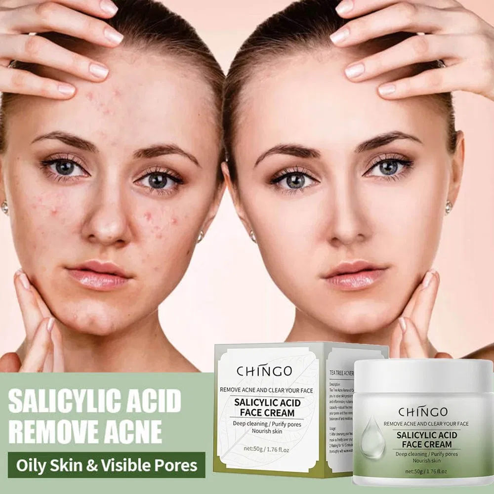 Gently Improves Smooth Refreshing Facial Soothing Moisturizing Anti-Acne Salicylic Acid Face Cream