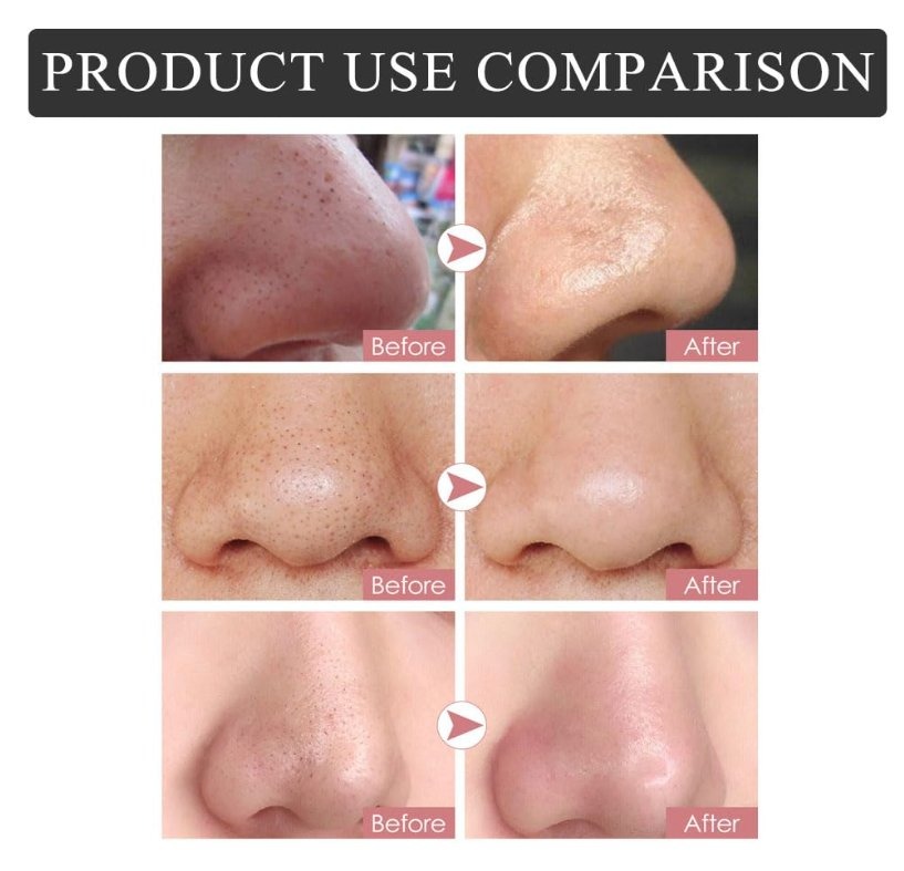 Quickly Removing Blackheads Shrink Pores White Nose Patch Mask