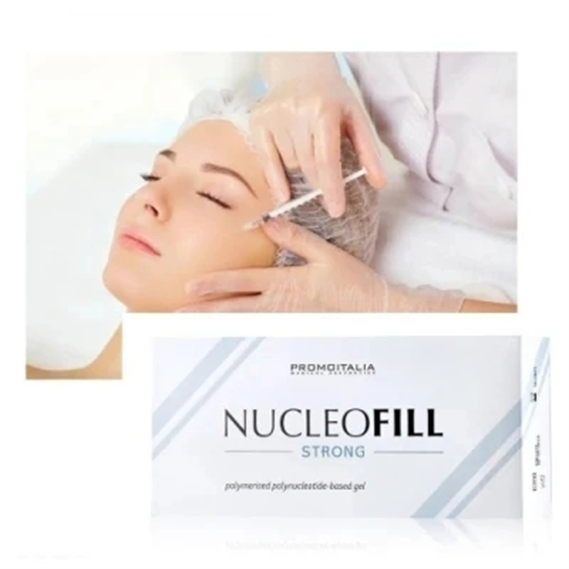 Nucleofill Strong Facial Skin Moisturizing Sodium Profhilo Dermal Filler Skin Rejuvenation